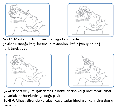 lma suprame yerleştirme