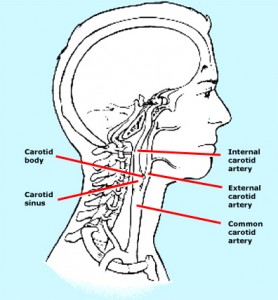 karotid masajı